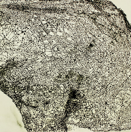 Translation en jaune  / Acrylique sur toile - Acrylics on canvas.  80 x 80 cm. 2014